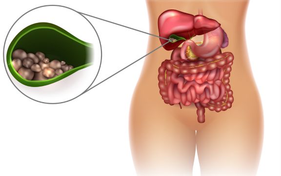 Na modelu prikazan i uvećan kamen u zuci.