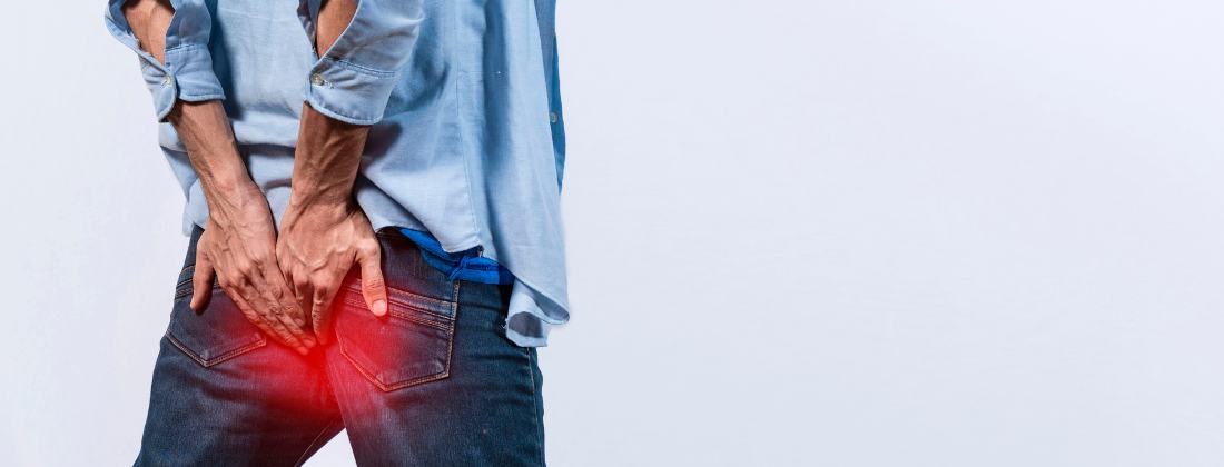 analna fistula slika